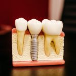 هزینه تحصیل دندانپزشکی در چین